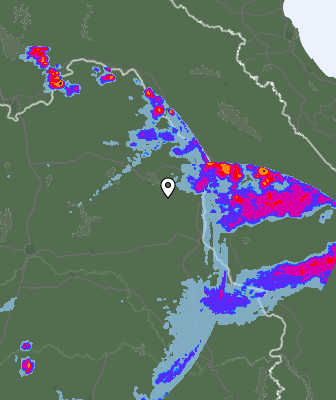 Radar