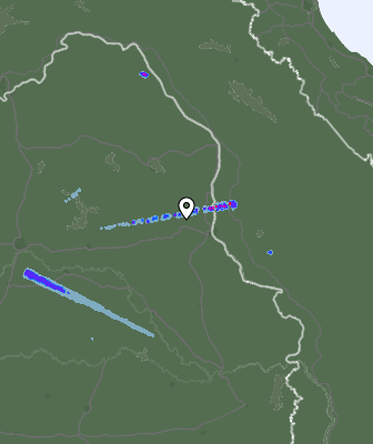Radar