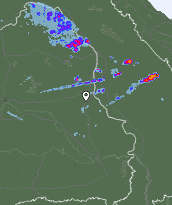 Radar