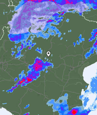 Radar