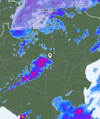 Radar