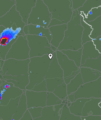 Radar