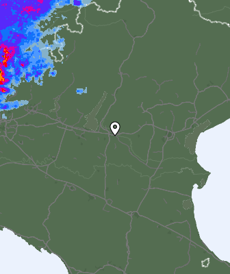 Radar