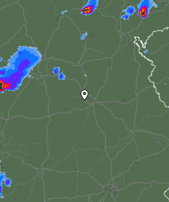 Radar