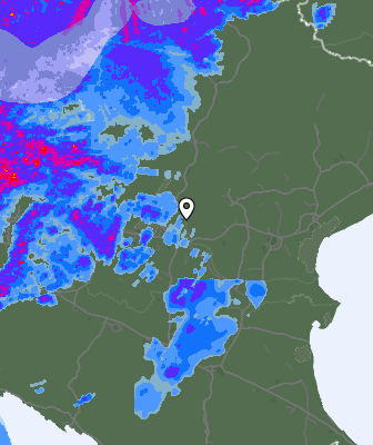 Radar