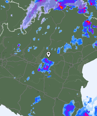 Radar