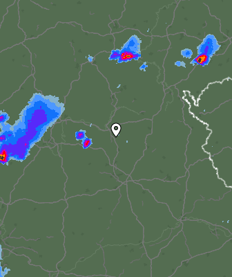 Radar