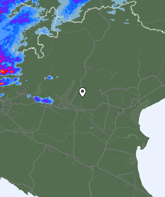 Radar