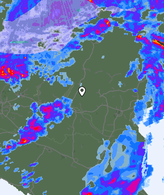 Radar