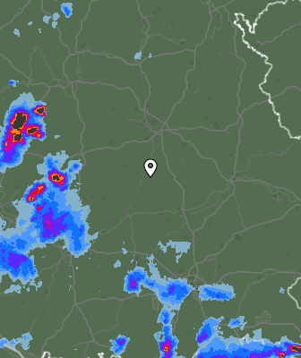Radar