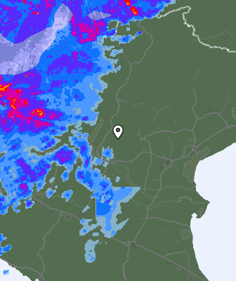Radar