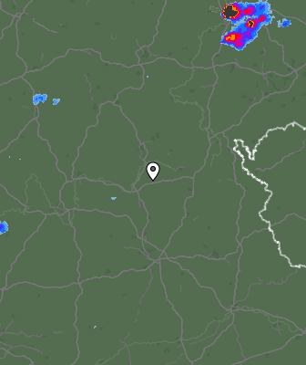 Radar