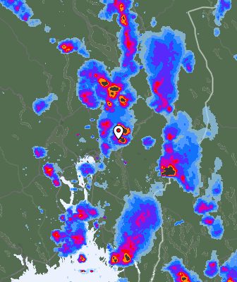Radar