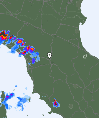 Radar