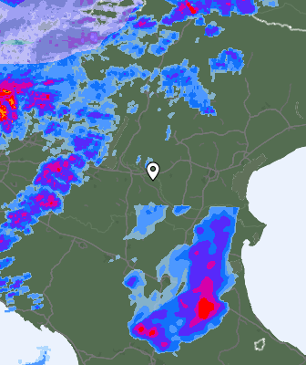Radar