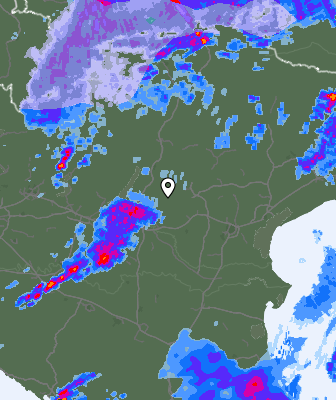 Radar
