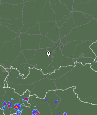 Radar