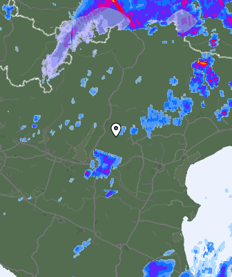 Radar