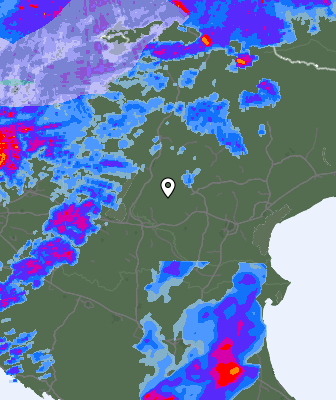 Radar