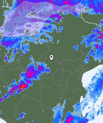 Radar