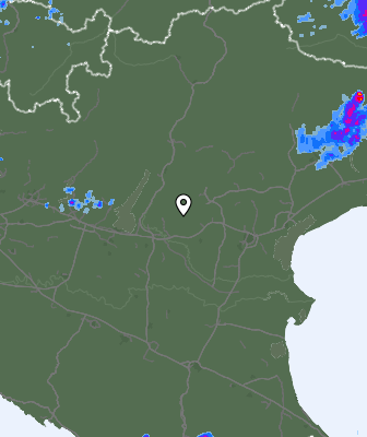 Radar