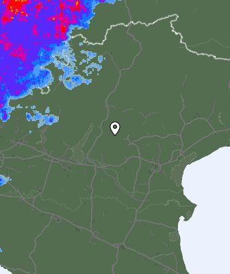 Radar