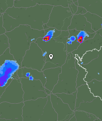 Radar