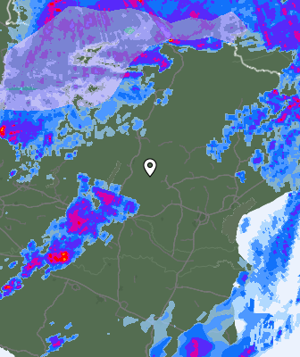 Radar