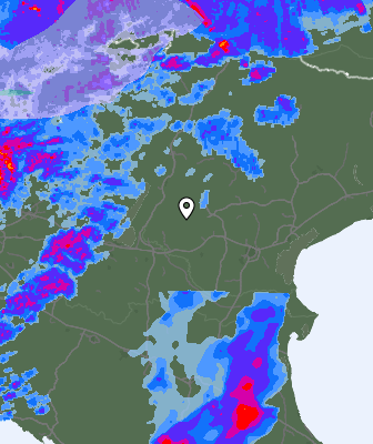 Radar