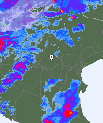 Radar