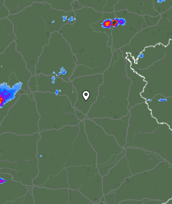 Radar