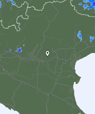 Radar