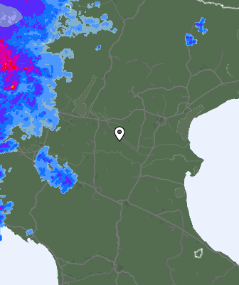 Radar