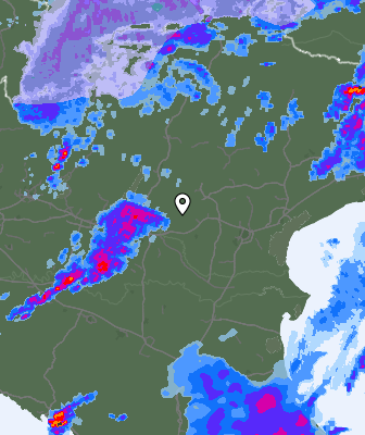 Radar