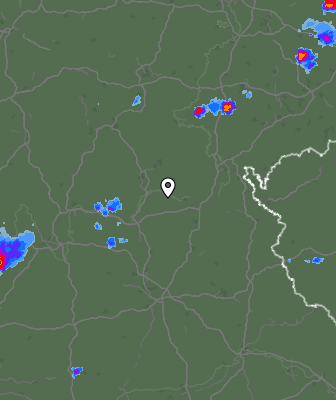 Radar