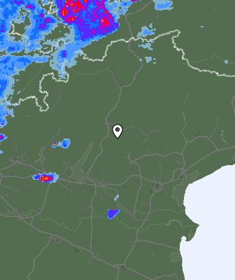 Radar