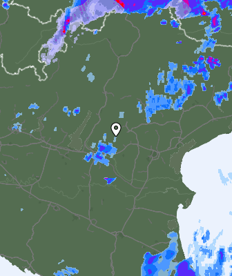 Radar