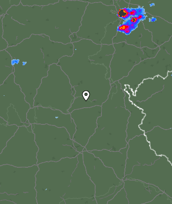Radar