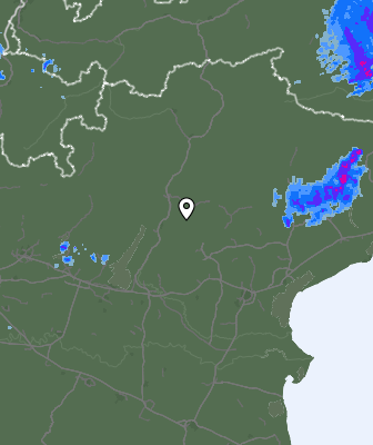 Radar