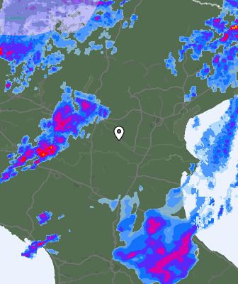 Radar