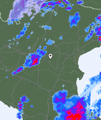 Radar