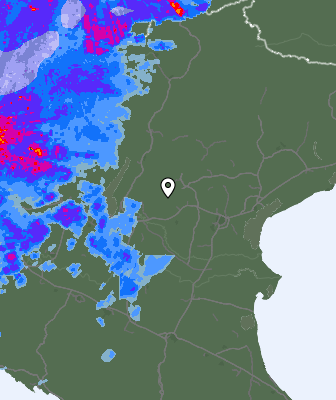 Radar