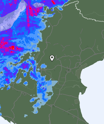 Radar