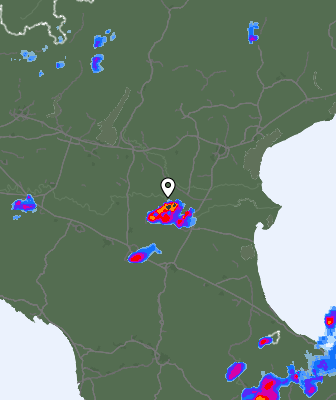 Radar