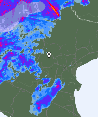 Radar