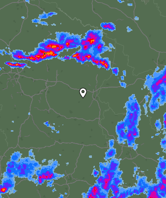 Radar