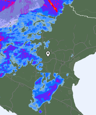 Radar