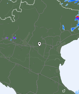 Radar