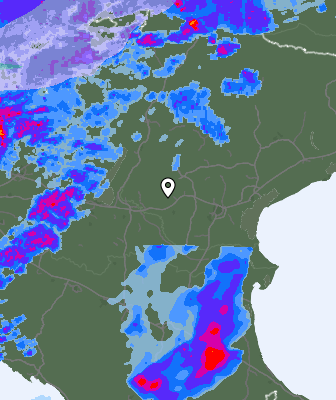 Radar