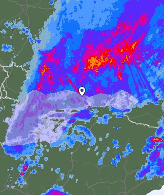 Radar